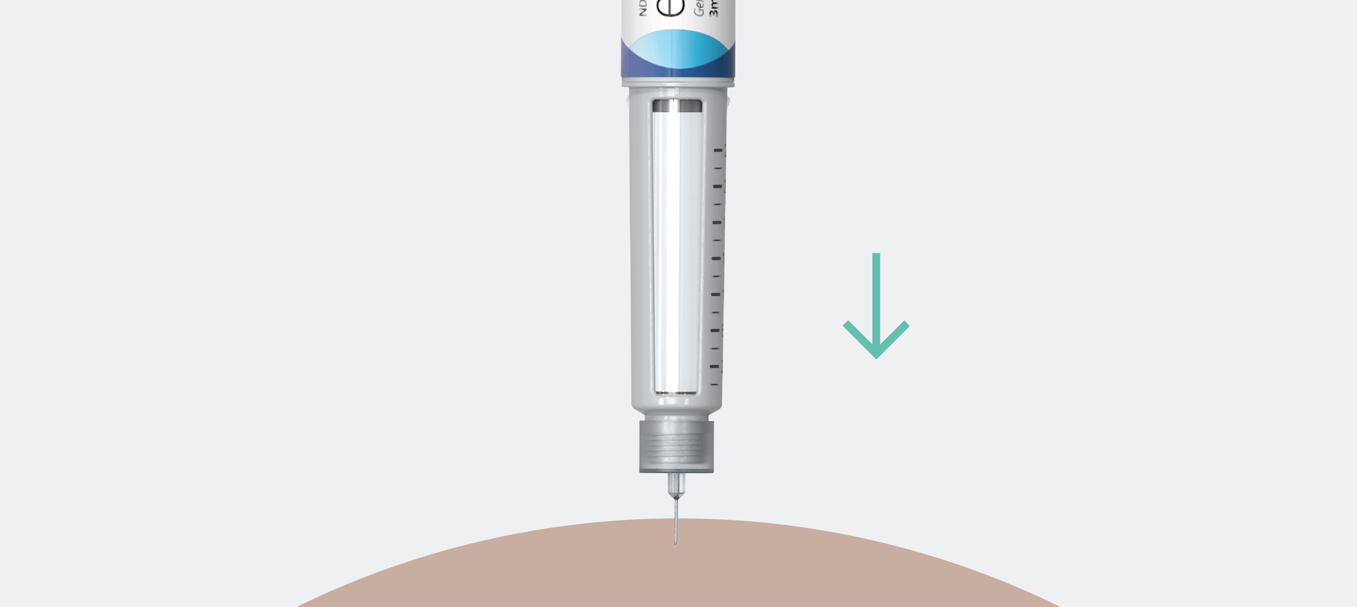 Step 4: Insert, inject and remove